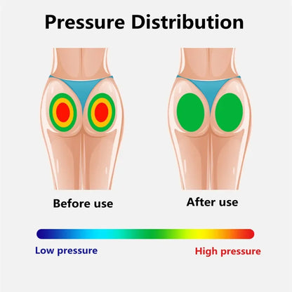 Silicone Egg Seat Cushion – Pressure Relief Pad